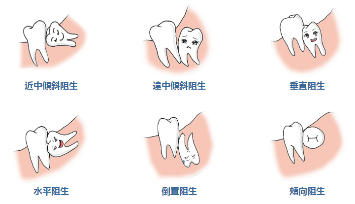 深圳拔智慧齒