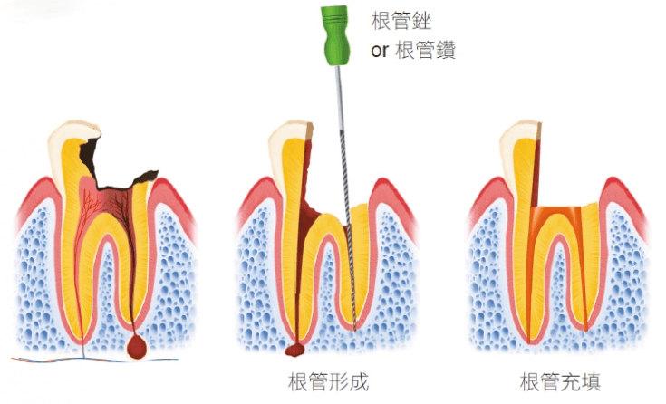 深圳杜牙根
